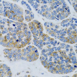 Invitrogen MBL2 Polyclonal Antibody 100 μL; Unconjugated:Antibodies,