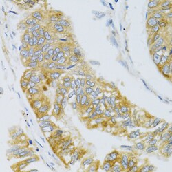 Invitrogen MBL2 Polyclonal Antibody 100 μL; Unconjugated:Antibodies,