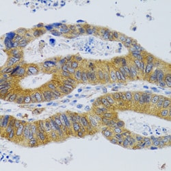 Invitrogen MBL2 Polyclonal Antibody 100 μL; Unconjugated:Antibodies,