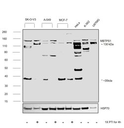 Invitrogen MBTPS1 Polyclonal Antibody 100 &mu;L; Unconjugated:Antibodies,