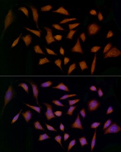 Invitrogen MDK Polyclonal Antibody 100 &mu;L; Unconjugated:Antibodies,