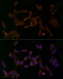 Invitrogen MDK Polyclonal Antibody 100 &mu;L; Unconjugated:Antibodies,