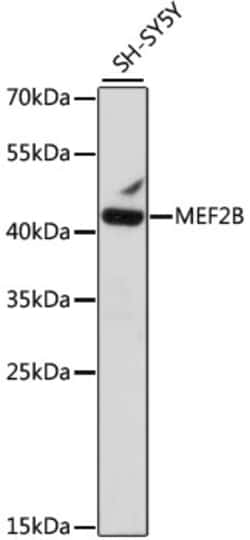 Invitrogen MEF2B Polyclonal Antibody 100 &mu;L; Unconjugated:Antibodies,