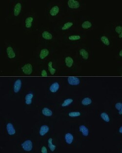 Invitrogen MKL1 Polyclonal Antibody 100 &mu;L; Unconjugated:Antibodies,