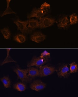 Invitrogen MMP25 Polyclonal Antibody 100 &mu;L; Unconjugated:Antibodies,