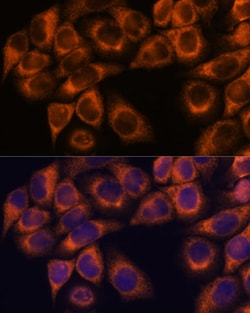Invitrogen MMP25 Polyclonal Antibody 100 &mu;L; Unconjugated:Antibodies,
