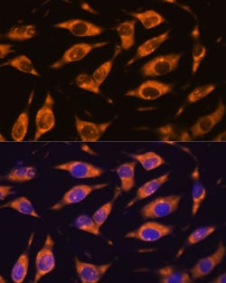 Invitrogen MMP25 Polyclonal Antibody 100 &mu;L; Unconjugated:Antibodies,