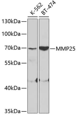 Invitrogen MMP25 Polyclonal Antibody 100 &mu;L; Unconjugated:Antibodies,