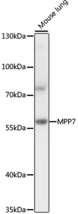 Invitrogen MPP7 Polyclonal Antibody 100 &mu;L; Unconjugated:Antibodies,