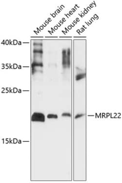 Invitrogen MRPL22 Polyclonal Antibody 100 &mu;L; Unconjugated:Antibodies,