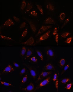 Invitrogen MRPL23 Polyclonal Antibody 100 μL; Unconjugated:Antibodies,