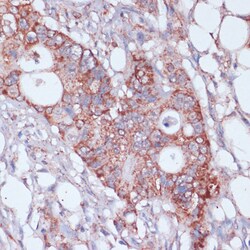 Invitrogen MRPL23 Polyclonal Antibody 100 μL; Unconjugated:Antibodies,