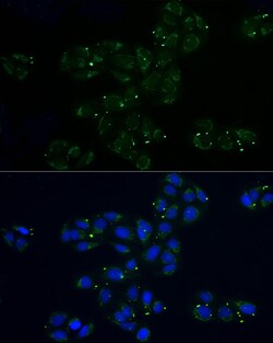 Invitrogen MRPL32 Polyclonal Antibody 100 &mu;L; Unconjugated:Antibodies,
