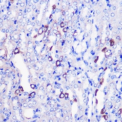 Invitrogen MRPL38 Polyclonal Antibody 100 &mu;L; Unconjugated:Antibodies,