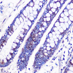 Invitrogen MRPL38 Polyclonal Antibody 100 &mu;L; Unconjugated:Antibodies,