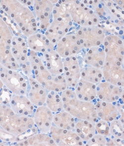 Invitrogen MTMR8 Polyclonal Antibody 100 &mu;L; Unconjugated:Antibodies,