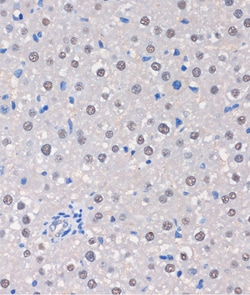 Invitrogen MTMR8 Polyclonal Antibody 100 &mu;L; Unconjugated:Antibodies,