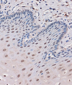 Invitrogen MTMR8 Polyclonal Antibody 100 &mu;L; Unconjugated:Antibodies,
