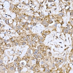 Invitrogen MT-ND6 Polyclonal Antibody 100 &mu;L; Unconjugated:Antibodies,
