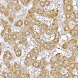 Invitrogen MT-ND6 Polyclonal Antibody 100 &mu;L; Unconjugated:Antibodies,