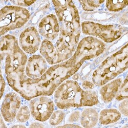Invitrogen MT-ND6 Polyclonal Antibody 100 &mu;L; Unconjugated:Antibodies,