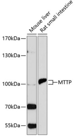Invitrogen MTTP Polyclonal Antibody 100 &mu;L; Unconjugated:Antibodies,