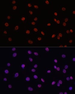 Invitrogen MYCT1 Polyclonal Antibody 100 &mu;L; Unconjugated:Antibodies,