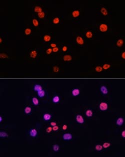 Invitrogen MYCT1 Polyclonal Antibody 100 &mu;L; Unconjugated:Antibodies,