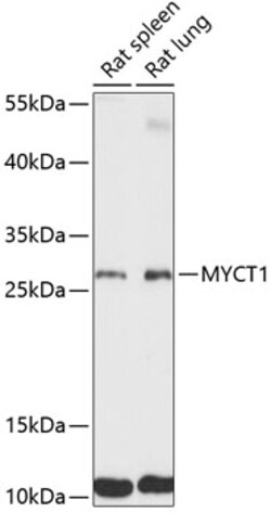Invitrogen MYCT1 Polyclonal Antibody 100 &mu;L; Unconjugated:Antibodies,
