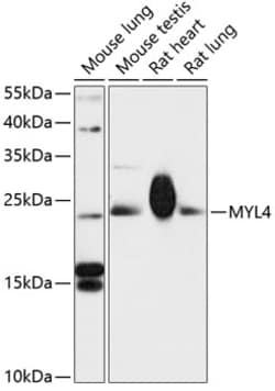Invitrogen MYL4 Polyclonal Antibody 100 &mu;L; Unconjugated:Antibodies,