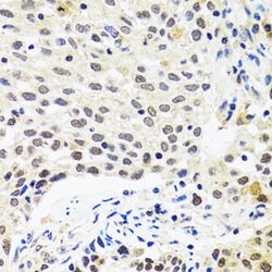 Myogenin Polyclonal Antibody, Invitrogen 100 &mu;L | Buy Online | Invitrogen | Fisher Scientific