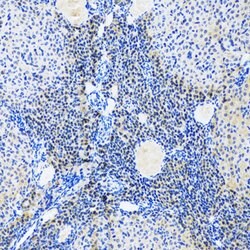 Myogenin Polyclonal Antibody, Invitrogen 100 &mu;L | Buy Online | Invitrogen | Fisher Scientific