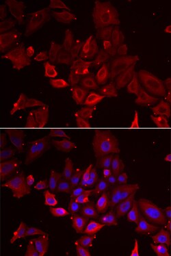 Invitrogen Myotilin Polyclonal Antibody 100 &mu;L; Unconjugated:Antibodies,