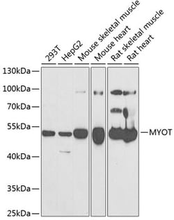 Invitrogen Myotilin Polyclonal Antibody 100 &mu;L; Unconjugated:Antibodies,