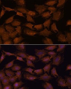 Invitrogen NCAPD2 Polyclonal Antibody 100 &mu;L; Unconjugated:Antibodies,