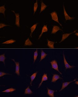 Invitrogen NCAPD2 Polyclonal Antibody 100 &mu;L; Unconjugated:Antibodies,