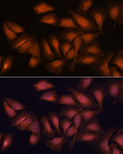 Invitrogen NCAPD2 Polyclonal Antibody 100 &mu;L; Unconjugated:Antibodies,