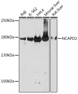 Invitrogen NCAPD2 Polyclonal Antibody 100 &mu;L; Unconjugated:Antibodies,