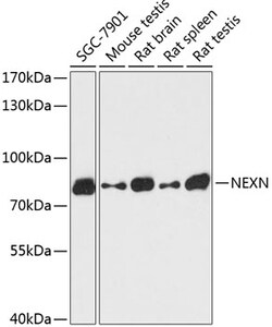 Invitrogen NEXN Polyclonal Antibody 100 &mu;L; Unconjugated:Antibodies,