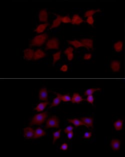 Invitrogen NGLY1 Polyclonal Antibody 100 &mu;L; Unconjugated:Antibodies,