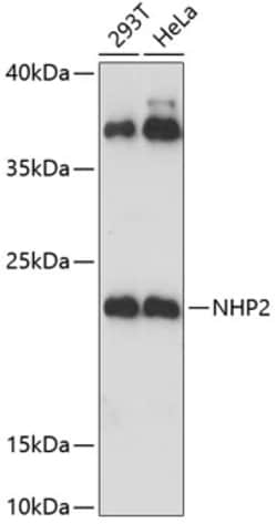 Invitrogen NHP2 Polyclonal Antibody 100 &mu;L; Unconjugated:Antibodies,