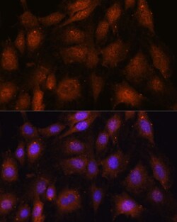 Invitrogen NOB1 Polyclonal Antibody 100 &mu;L; Unconjugated:Antibodies,