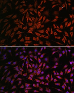 Invitrogen NOB1 Polyclonal Antibody 100 &mu;L; Unconjugated:Antibodies,