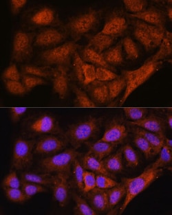 Invitrogen NOB1 Polyclonal Antibody 100 &mu;L; Unconjugated:Antibodies,