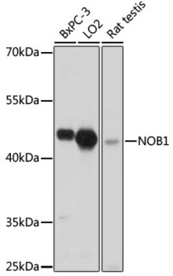 Invitrogen NOB1 Polyclonal Antibody 100 &mu;L; Unconjugated:Antibodies,