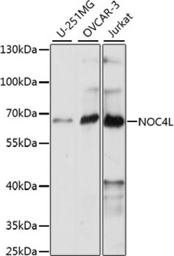 Invitrogen NOC4L Polyclonal Antibody 100 &mu;L; Unconjugated:Antibodies,