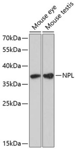 NPL Polyclonal Antibody, Invitrogen 100 μL; Unconjugated:Antibodies, |  Fisher Scientific