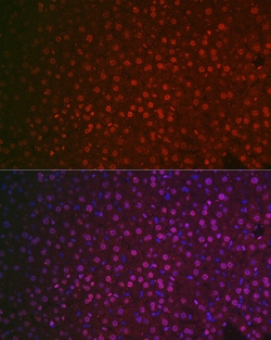Invitrogen NR5A2 Polyclonal Antibody 100 &mu;L; Unconjugated:Antibodies,