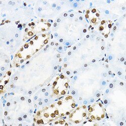 Invitrogen NR5A2 Polyclonal Antibody 100 &mu;L; Unconjugated:Antibodies,