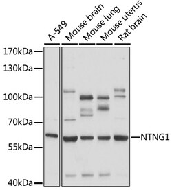 Invitrogen NTNG1 Polyclonal Antibody 100 &mu;L | Buy Online | Invitrogen&trade; | Fisher Scientific